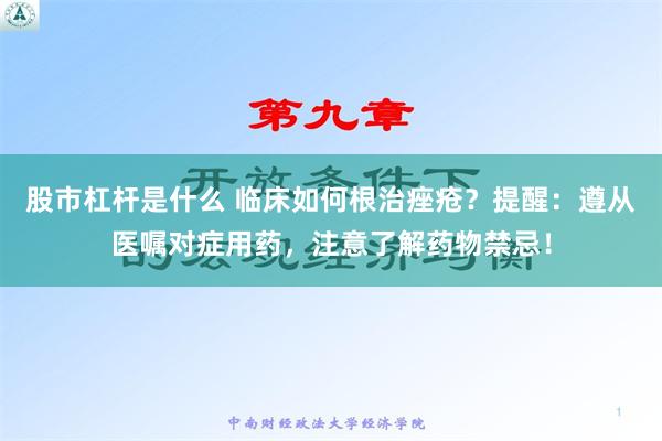 股市杠杆是什么 临床如何根治痤疮？提醒：遵从医嘱对症用药，注意了解药物禁忌！